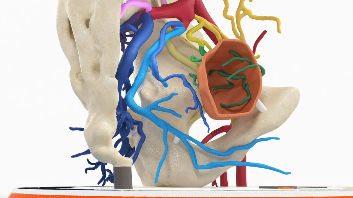 Internal Iliac Arteries - Male, 81 Years