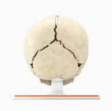 Infant Skull, Normal - Male, 8 Months