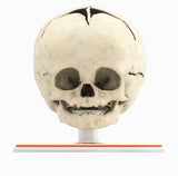 Infant Skull, Normal - Male, 8 Months