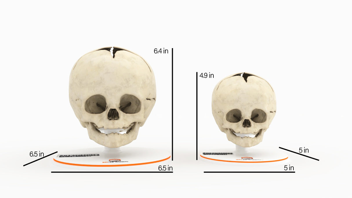 Infant Skull, Normal - Male, 8 Months