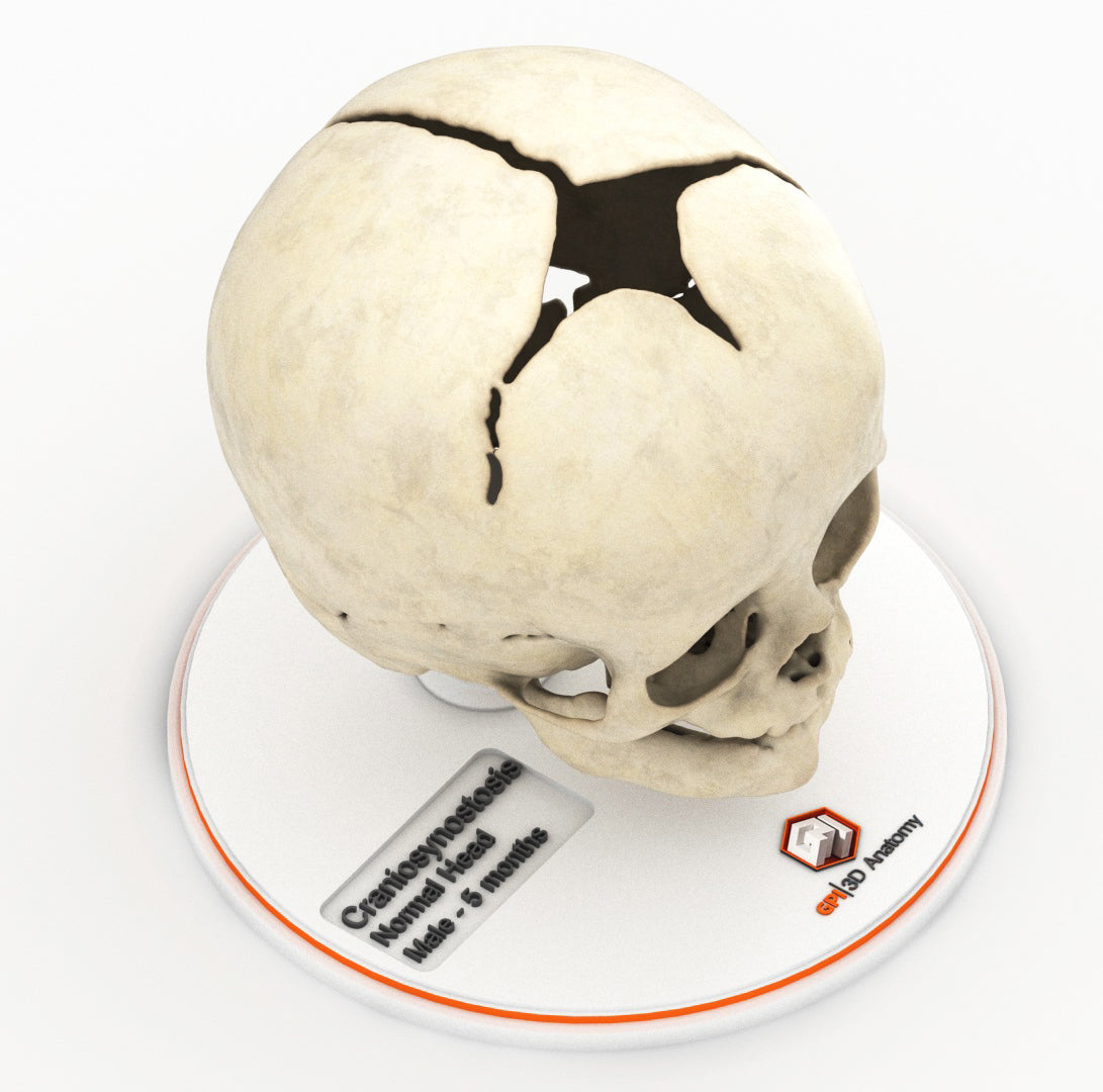 Custom 3D Anatomy Models | Infant Skull | 8 Month Old Male – GPI