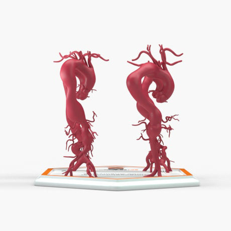 Thoracoabdominal Aortic Aneurysms 1-4