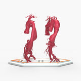 Thoracoabdominal Aortic Aneurysms 1-4