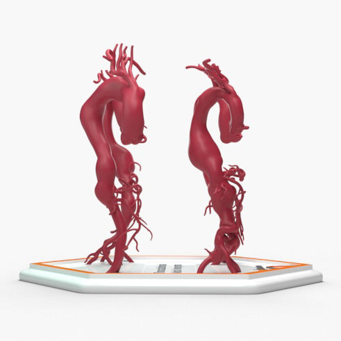 Thoracoabdominal Aortic Aneurysms 1-4