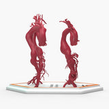 Thoracoabdominal Aortic Aneurysms 1-4