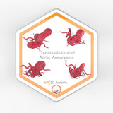 Thoracoabdominal Aortic Aneurysms 1-4