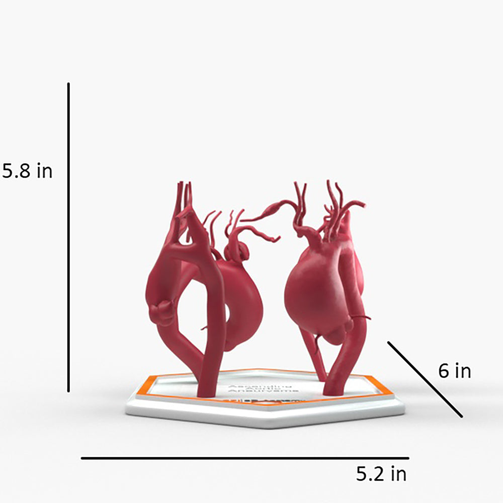 Ascending Aortic Aneurysms 1