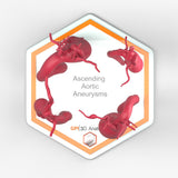 Ascending Aortic Aneurysms 1