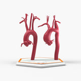 Ascending Supracoronary Aortic Aneurysm and Normal