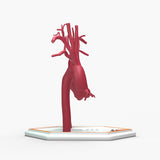 Ascending Supracoronary Aortic Aneurysm and Normal