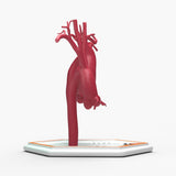 Supracoronary Ascending Aortic Aneurysm Left Carotid Variant and Normal