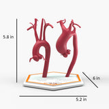 Supracoronary Ascending Aortic Aneurysm Left Carotid Variant and Normal