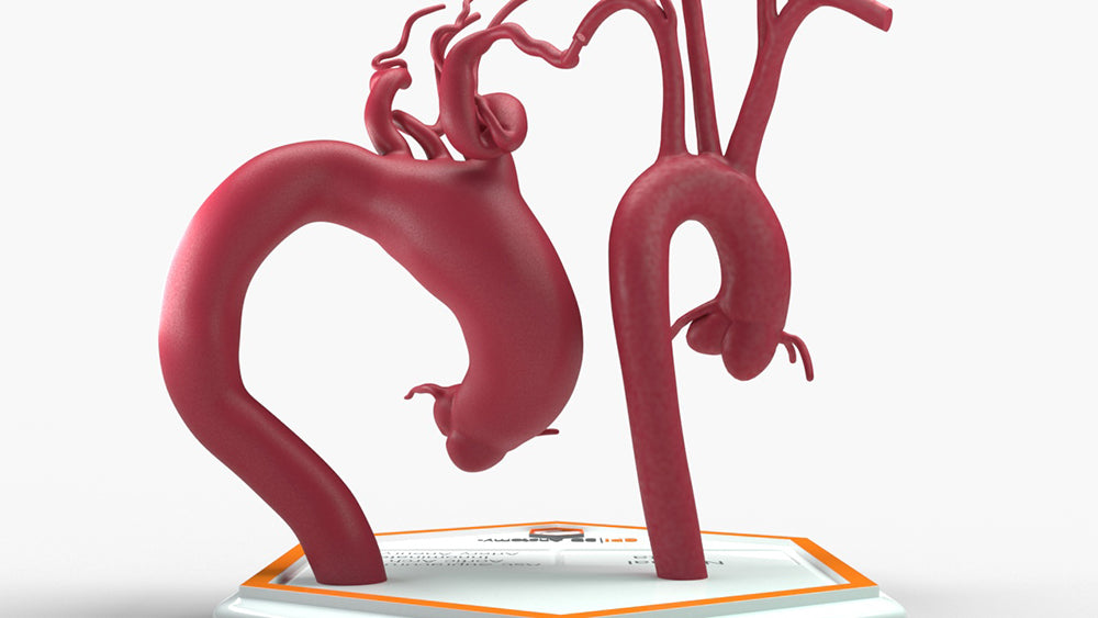 Ascending Supracoronary Aortic Arch and Innominate Artery Aneurysm and Normal