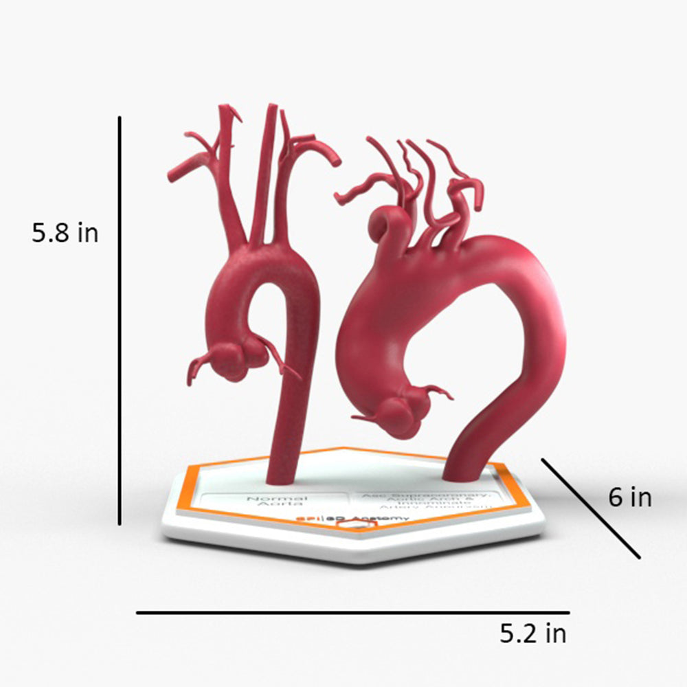 Ascending Supracoronary Aortic Arch and Innominate Artery Aneurysm and Normal