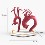 Ascending Supracoronary Aortic Arch and Innominate Artery Aneurysm and Normal
