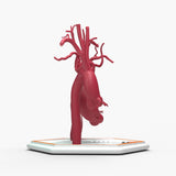 Ascending Supracoronary Aortic Arch and Innominate Artery Aneurysm and Normal