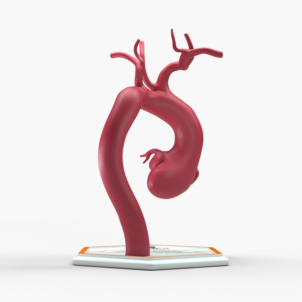 Marfanoid Aortic Root and Sinus of Valsalva Aneurysm