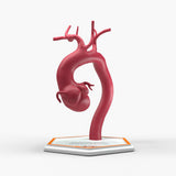 Marfanoid Aortic Root and Sinus of Valsalva Aneurysm