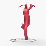 Fusiform Ascending & Descending Aortic Aneurysm 1