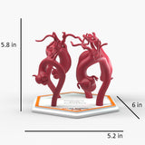 Ascending Aortic Aneurysms 2
