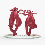 Ascending Aortic Aneurysms 2