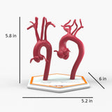 Marfanoid Aortic Root Aneurysm and Normal