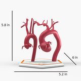 Marfanoid Aortic Root and Sinus of Valsalva Aneurysm and Normal