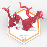 Marfanoid Aortic Root and Sinus of Valsalva Aneurysm and Normal