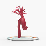 Fusiform Ascending & Descending Aortic Aneurysm 2 and Normal
