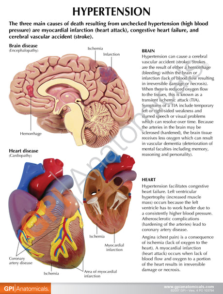 Hypertension Set Education Card