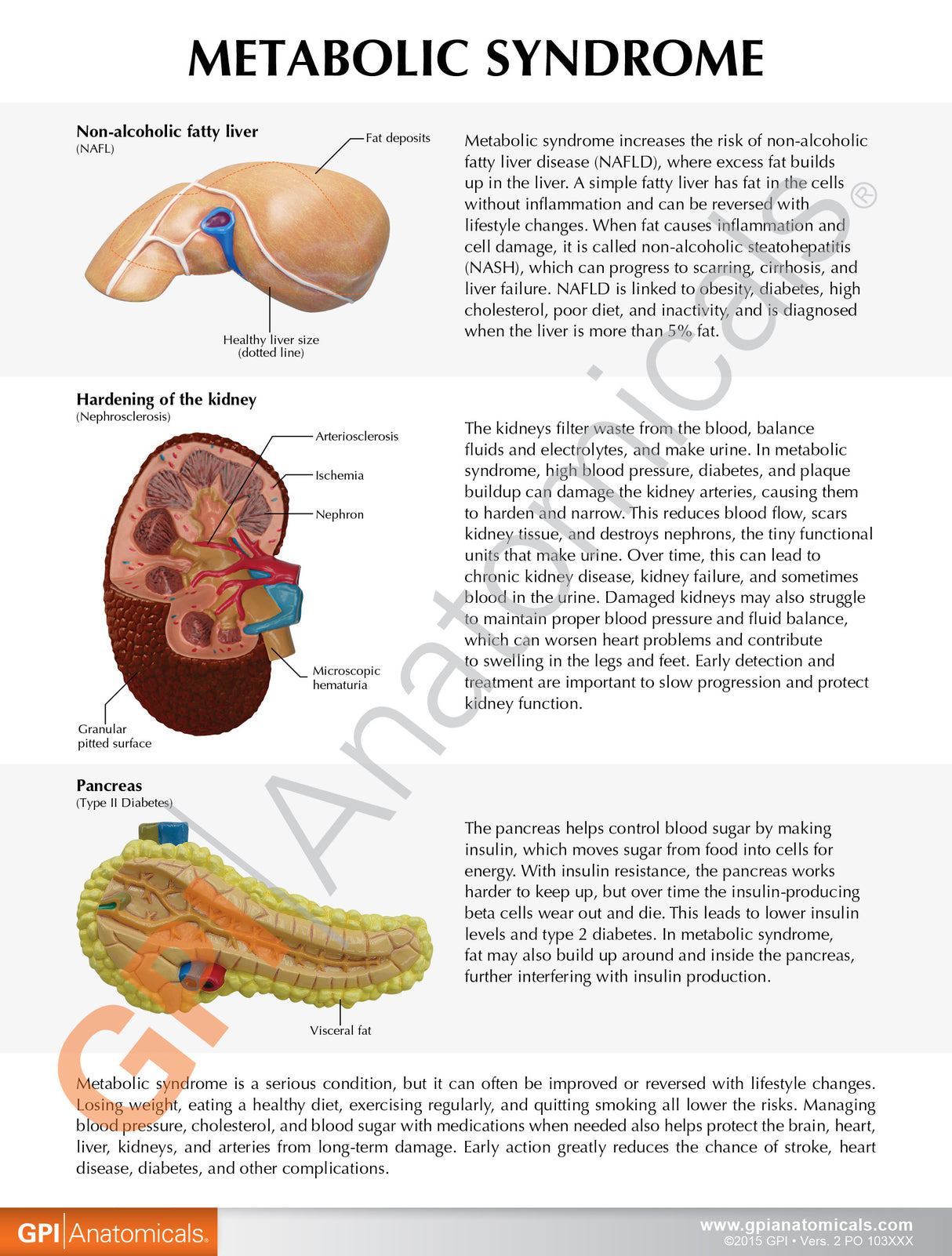 Metabolic Syndrome Education Card