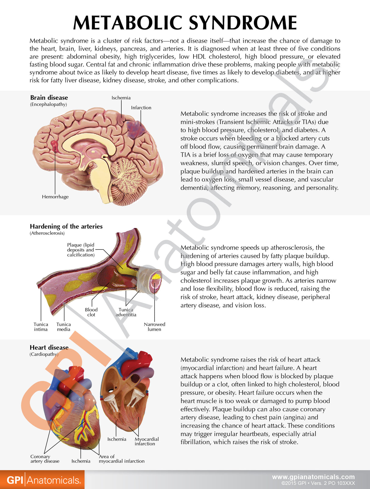 Metabolic Syndrome Education Card