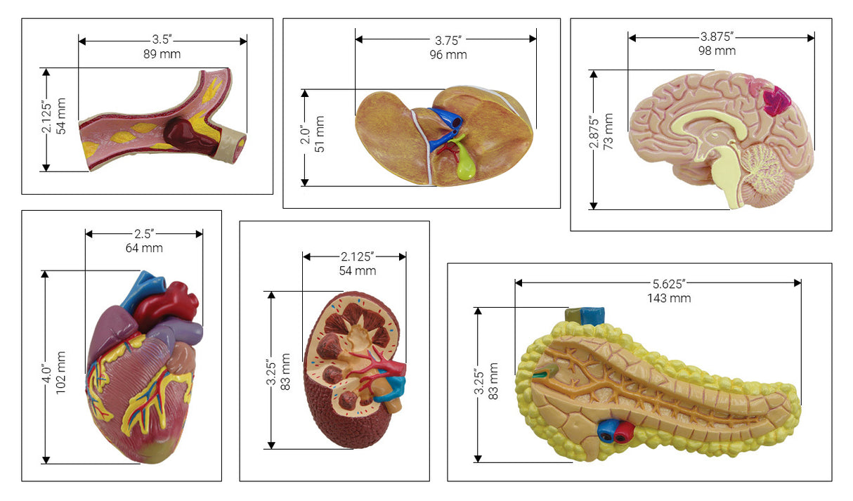 Metabolic Syndrome Model Set