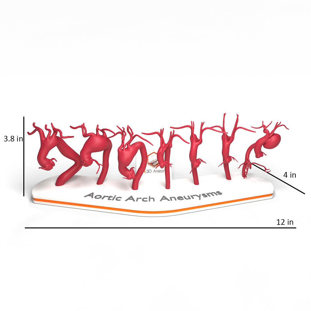 Aortic Arch Aneurysm Set