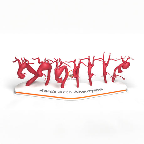 Aortic Arch Aneurysm Set