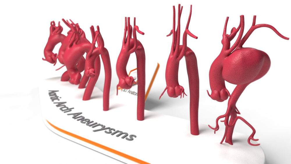 Aortic Arch Aneurysm Set