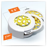 Osteoporosis Model