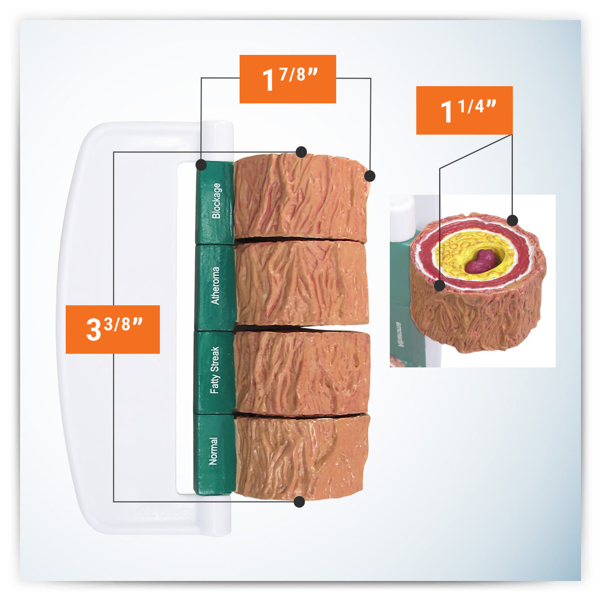 4-Piece Artery Model