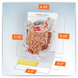 GI Tract Model with Common Pathologies