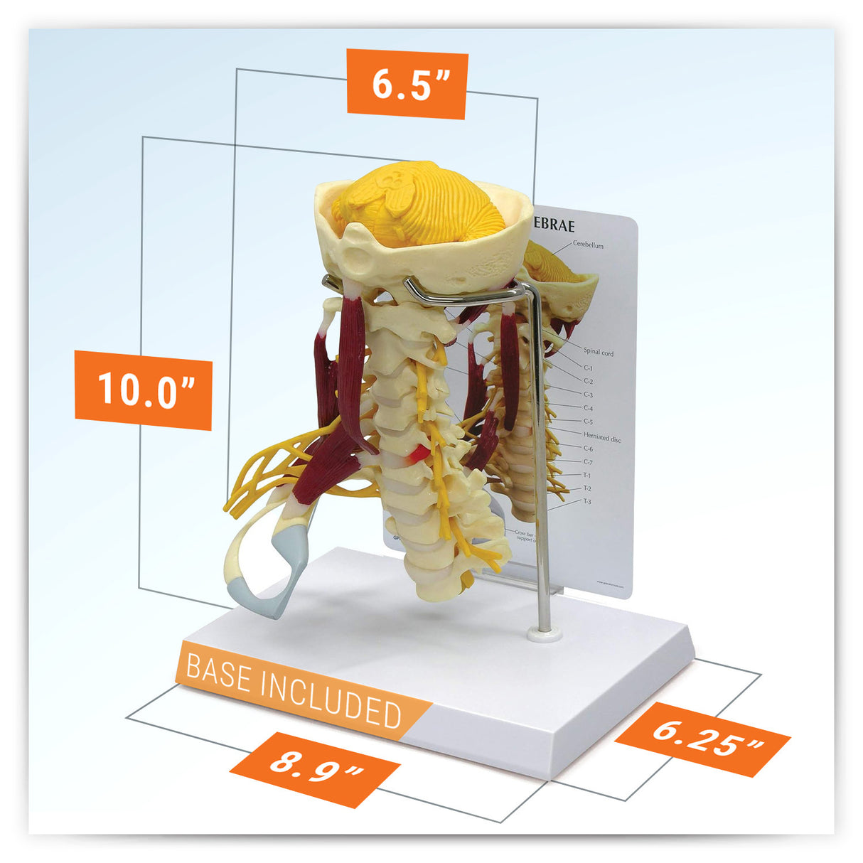 Deluxe Muscled Cervical Vertebrae Model