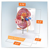 Normal and Diseased Kidney Model
