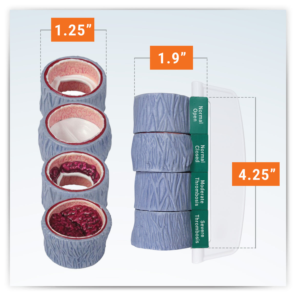 4-Piece Vein Model with Blood Clot