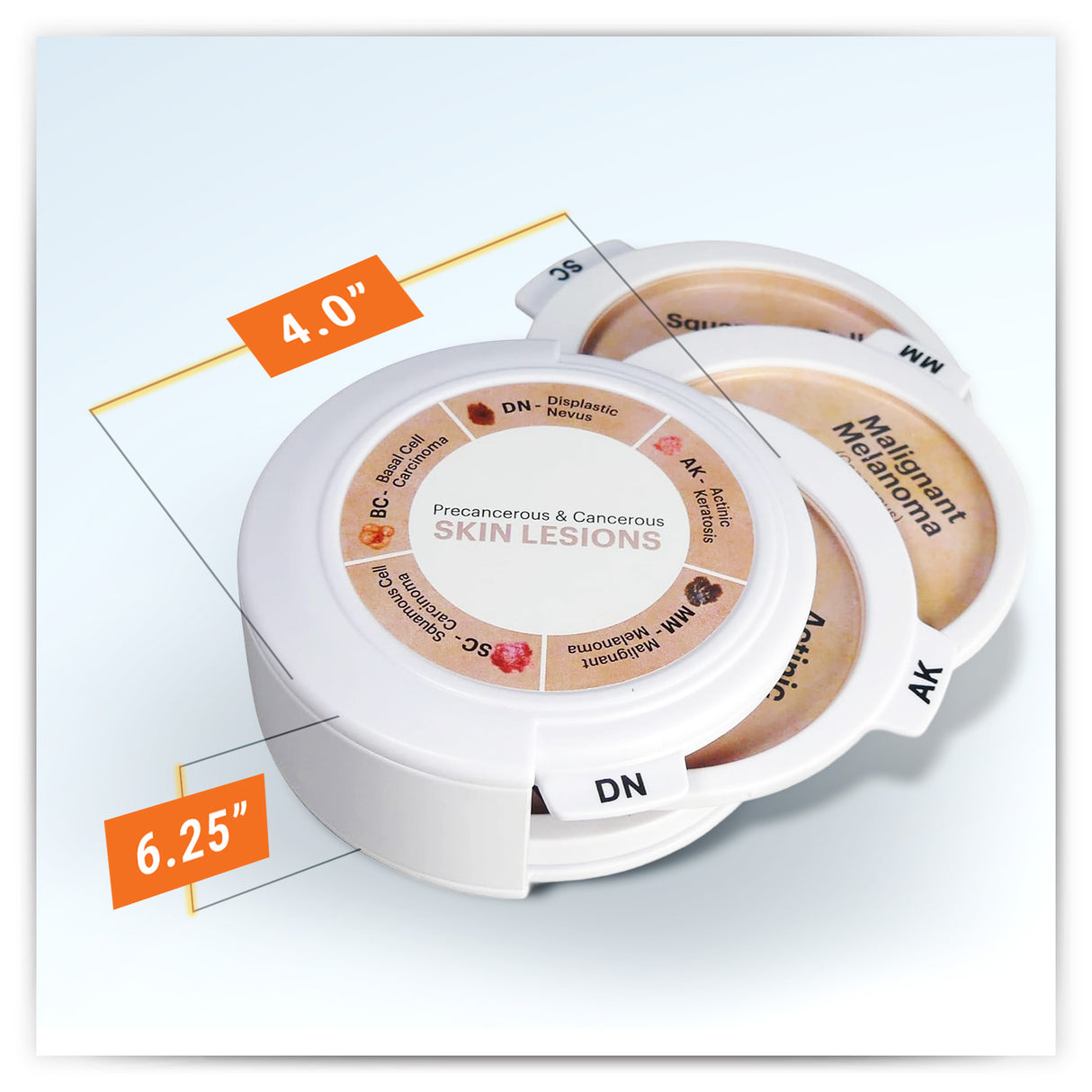 Skin Cancer Model