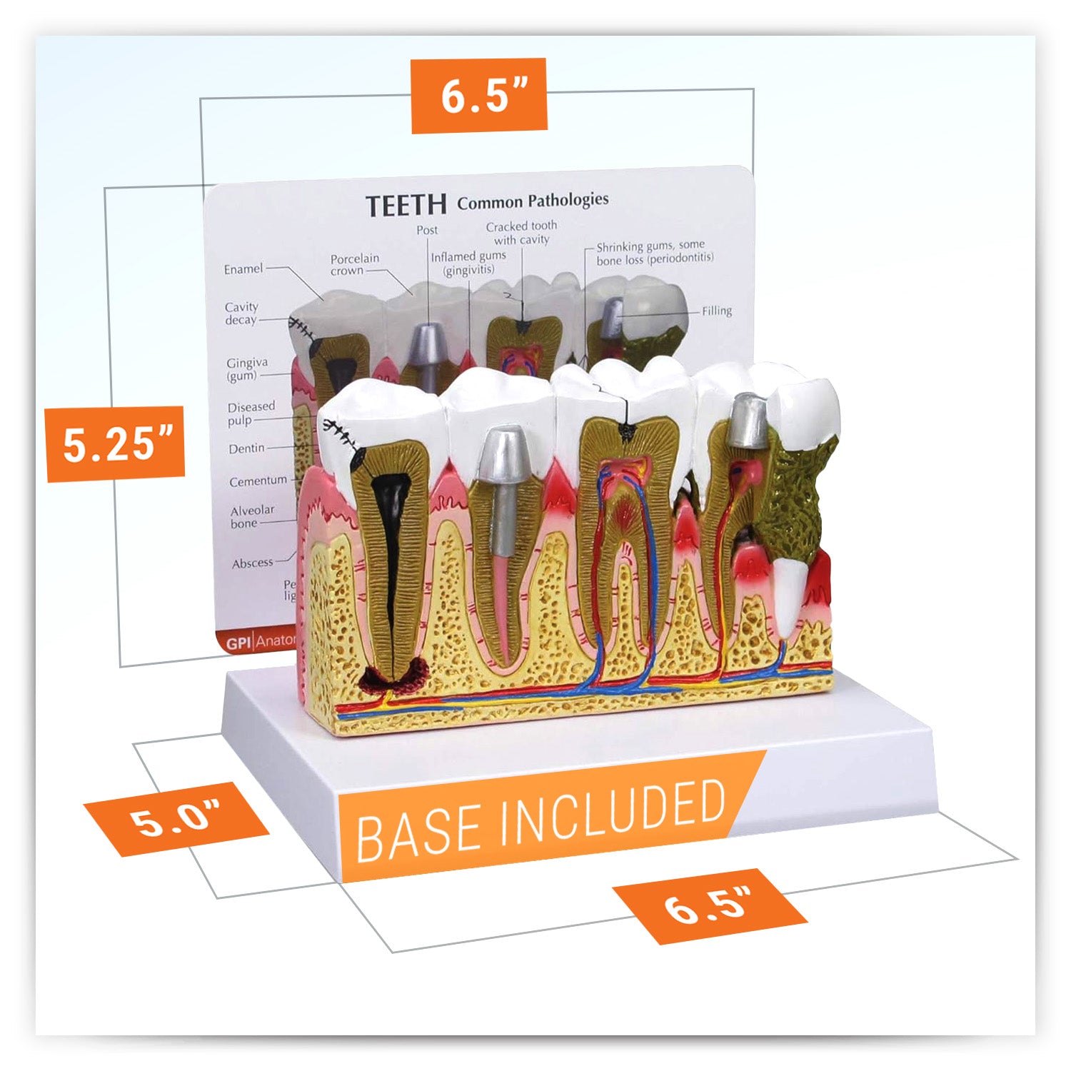 Teeth Model – GPI 3D Anatomy