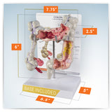 Colon Model with Common Pathologies