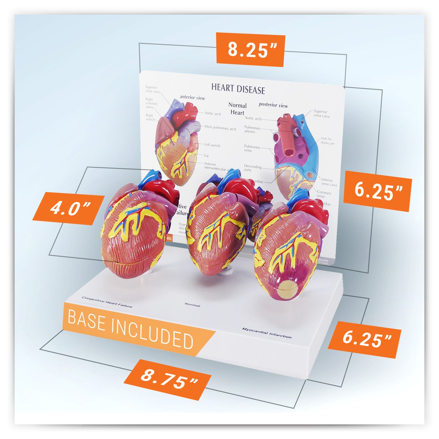 3-Piece Mini Heart Model Set – GPI 3D Anatomy