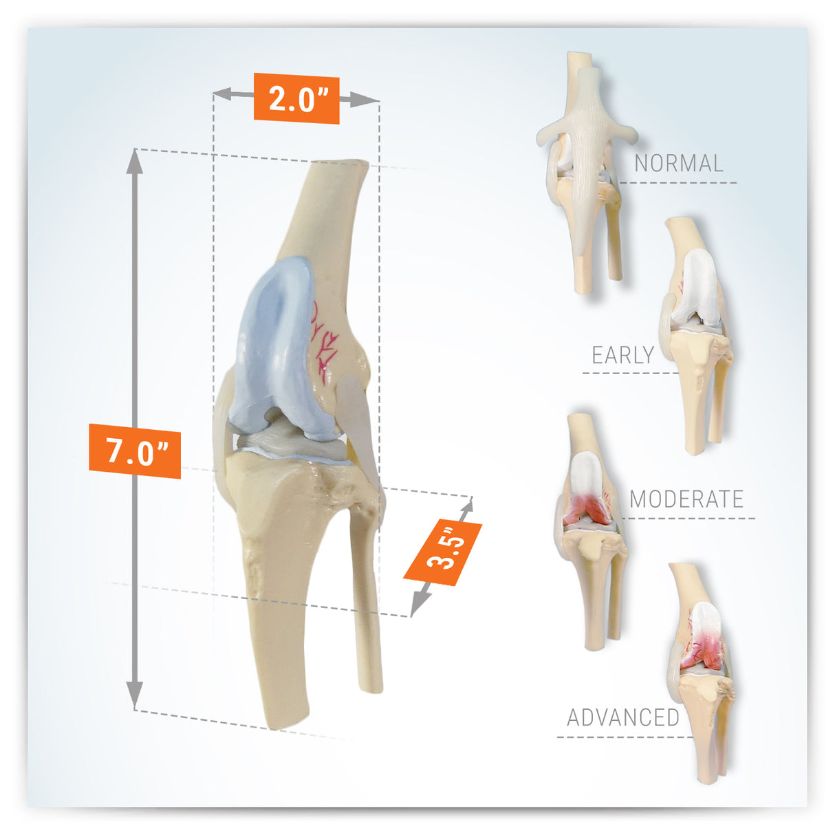 4-Stage Canine Knee Model Set