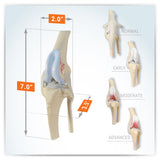 4-Stage Canine Knee Model Set