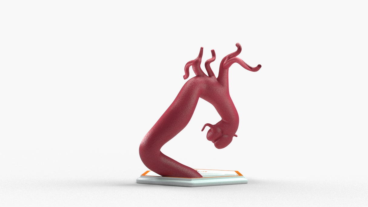 Aortic Arch - Fusiform with Proximal Descending Aneurysm