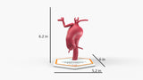 Aortic Arch - Fusiform Ascending Aneurysm